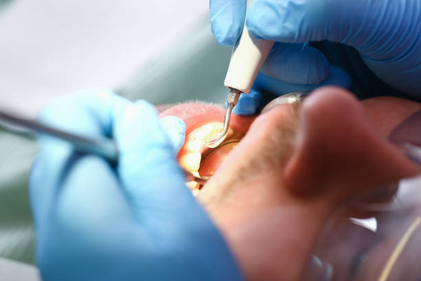 Best Weekend Emergency Dental Services in Albany, MN